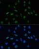 Immunofluorescence analysis of U-2 OS cells using MKL1 Polyclonal Antibody (23-628) at dilution of 1:100 (40x lens) . Blue: DAPI for nuclear staining.
