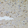 Immunohistochemistry of paraffin-embedded rat brain using MTIF3 antibody (23-638) at dilution of 1:100 (40x lens) .