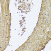 Immunohistochemistry of paraffin-embedded mouse heart using PIK3C2A antibody (23-640) at dilution of 1:100 (40x lens) .