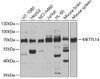 Western blot analysis of extracts of various cell lines, using METTL14 antibody (23-641) at 1:1000 dilution.<br/>Secondary antibody: HRP Goat Anti-Rabbit IgG (H+L) at 1:10000 dilution.<br/>Lysates/proteins: 25ug per lane.<br/>Blocking buffer: 3% nonfat dry milk in TBST.<br/>Detection: ECL Basic Kit.<br/>Exposure time: 10s.