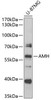 Western blot analysis of extracts of U-87MG cells, using AMH antibody (23-645) at 1:1000 dilution.<br/>Secondary antibody: HRP Goat Anti-Rabbit IgG (H+L) at 1:10000 dilution.<br/>Lysates/proteins: 25ug per lane.<br/>Blocking buffer: 3% nonfat dry milk in TBST.<br/>Detection: ECL Basic Kit.<br/>Exposure time: 90s.