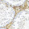 Immunohistochemistry of paraffin-embedded mouse leydig cells using AMH antibody (23-645) at dilution of 1:100 (40x lens) .