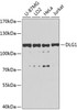 Western blot analysis of extracts of various cell lines, using DLG1 antibody (23-649) at 1:1000 dilution.<br/>Secondary antibody: HRP Goat Anti-Rabbit IgG (H+L) at 1:10000 dilution.<br/>Lysates/proteins: 25ug per lane.<br/>Blocking buffer: 3% nonfat dry milk in TBST.<br/>Detection: ECL Basic Kit.<br/>Exposure time: 90s.