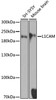 Western blot analysis of extracts of various cell lines, using L1CAM antibody (23-656) at 1:1000 dilution.<br/>Secondary antibody: HRP Goat Anti-Rabbit IgG (H+L) at 1:10000 dilution.<br/>Lysates/proteins: 25ug per lane.<br/>Blocking buffer: 3% nonfat dry milk in TBST.<br/>Detection: ECL Basic Kit.<br/>Exposure time: 30s.