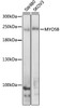 Western blot analysis of extracts of various cell lines, using MYO5B antibody (23-658) at 1:1000 dilution.<br/>Secondary antibody: HRP Goat Anti-Rabbit IgG (H+L) at 1:10000 dilution.<br/>Lysates/proteins: 25ug per lane.<br/>Blocking buffer: 3% nonfat dry milk in TBST.<br/>Detection: ECL Enhanced Kit.<br/>Exposure time: 30s.