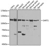 Western blot analysis of extracts of various cell lines, using SART1 antibody (23-663) at 1:1000 dilution.<br/>Secondary antibody: HRP Goat Anti-Rabbit IgG (H+L) at 1:10000 dilution.<br/>Lysates/proteins: 25ug per lane.<br/>Blocking buffer: 3% nonfat dry milk in TBST.<br/>Detection: ECL Basic Kit.<br/>Exposure time: 10s.