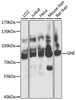 Western blot analysis of extracts of various cell lines, using GNE antibody (23-664) at 1:1000 dilution.<br/>Secondary antibody: HRP Goat Anti-Rabbit IgG (H+L) at 1:10000 dilution.<br/>Lysates/proteins: 25ug per lane.<br/>Blocking buffer: 3% nonfat dry milk in TBST.<br/>Detection: ECL Basic Kit.<br/>Exposure time: 10s.