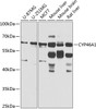 Western blot analysis of extracts of various cell lines, using CYP46A1 antibody (23-667) at 1:1000 dilution.<br/>Secondary antibody: HRP Goat Anti-Rabbit IgG (H+L) at 1:10000 dilution.<br/>Lysates/proteins: 25ug per lane.<br/>Blocking buffer: 3% nonfat dry milk in TBST.<br/>Detection: ECL Basic Kit.<br/>Exposure time: 10s.