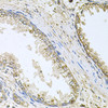 Immunohistochemistry of paraffin-embedded human prostate using CYP46A1 antibody (23-667) at dilution of 1:100 (40x lens) .