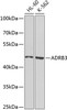 Western blot analysis of extracts of various cell lines, using ADRB3 antibody (23-687) at 1:1000 dilution.<br/>Secondary antibody: HRP Goat Anti-Rabbit IgG (H+L) at 1:10000 dilution.<br/>Lysates/proteins: 25ug per lane.<br/>Blocking buffer: 3% nonfat dry milk in TBST.<br/>Detection: ECL Basic Kit.<br/>Exposure time: 5s.