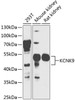 Western blot analysis of extracts of various cell lines, using KCNK9 antibody (23-688) at 1:1000 dilution.<br/>Secondary antibody: HRP Goat Anti-Rabbit IgG (H+L) at 1:10000 dilution.<br/>Lysates/proteins: 25ug per lane.<br/>Blocking buffer: 3% nonfat dry milk in TBST.<br/>Detection: ECL Enhanced Kit.<br/>Exposure time: 15s.