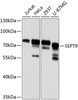 Western blot analysis of extracts of various cell lines, using SEPT9 antibody (23-699) at 1:3000 dilution.<br/>Secondary antibody: HRP Goat Anti-Rabbit IgG (H+L) at 1:10000 dilution.<br/>Lysates/proteins: 25ug per lane.<br/>Blocking buffer: 3% nonfat dry milk in TBST.<br/>Detection: ECL Basic Kit.<br/>Exposure time: 5s.