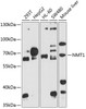 Western blot analysis of extracts of various cell lines, using NMT1 antibody (23-709) at 1:1000 dilution._Secondary antibody: HRP Goat Anti-Rabbit IgG (H+L) at 1:10000 dilution._Lysates/proteins: 25ug per lane._Blocking buffer: 3% nonfat dry milk in TBST._Detection: ECL Enhanced Kit._Exposure time: 90s.