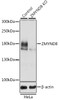 Western blot analysis of extracts from normal (control) and ZMYND8 knockout (KO) HeLa cells, using ZMYND8 antibody (23-711) at 1:3000 dilution.<br/>Secondary antibody: HRP Goat Anti-Rabbit IgG (H+L) at 1:10000 dilution.<br/>Lysates/proteins: 25ug per lane.<br/>Blocking buffer: 3% nonfat dry milk in TBST.<br/>Detection: ECL Basic Kit.<br/>Exposure time: 1s.