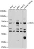 Western blot analysis of extracts of various cell lines, using CRNN antibody (23-719) at 1:1000 dilution.<br/>Secondary antibody: HRP Goat Anti-Rabbit IgG (H+L) at 1:10000 dilution.<br/>Lysates/proteins: 25ug per lane.<br/>Blocking buffer: 3% nonfat dry milk in TBST.<br/>Detection: ECL Basic Kit.<br/>Exposure time: 10s.