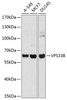 Western blot analysis of extracts of various cell lines, using VPS33B antibody (23-726) at 1:1000 dilution.<br/>Secondary antibody: HRP Goat Anti-Rabbit IgG (H+L) at 1:10000 dilution.<br/>Lysates/proteins: 25ug per lane.<br/>Blocking buffer: 3% nonfat dry milk in TBST.<br/>Detection: ECL Basic Kit.<br/>Exposure time: 1s.