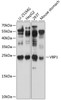 Western blot analysis of extracts of various cell lines, using VBP1 antibody (23-769) at 1:1000 dilution.<br/>Secondary antibody: HRP Goat Anti-Rabbit IgG (H+L) at 1:10000 dilution.<br/>Lysates/proteins: 25ug per lane.<br/>Blocking buffer: 3% nonfat dry milk in TBST.<br/>Detection: ECL Basic Kit.<br/>Exposure time: 1s.