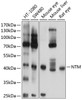 Western blot analysis of extracts of various cell lines, using NTM antibody (23-771) at 1:1000 dilution.<br/>Secondary antibody: HRP Goat Anti-Rabbit IgG (H+L) at 1:10000 dilution.<br/>Lysates/proteins: 25ug per lane.<br/>Blocking buffer: 3% nonfat dry milk in TBST.<br/>Detection: ECL Basic Kit.<br/>Exposure time: 5s.