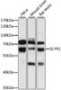 Western blot analysis of extracts of various cell lines, using GLYR1 antibody (23-780) at 1:1000 dilution.<br/>Secondary antibody: HRP Goat Anti-Rabbit IgG (H+L) at 1:10000 dilution.<br/>Lysates/proteins: 25ug per lane.<br/>Blocking buffer: 3% nonfat dry milk in TBST.<br/>Detection: ECL Basic Kit.<br/>Exposure time: 5s.
