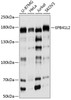 Western blot analysis of extracts of various cell lines, using EPB41L2 antibody (23-791) at 1:1000 dilution.<br/>Secondary antibody: HRP Goat Anti-Rabbit IgG (H+L) at 1:10000 dilution.<br/>Lysates/proteins: 25ug per lane.<br/>Blocking buffer: 3% nonfat dry milk in TBST.<br/>Detection: ECL Basic Kit.<br/>Exposure time: 5s.