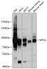 Western blot analysis of extracts of various cell lines, using MTO1 antibody (23-798) at 1:1000 dilution.<br/>Secondary antibody: HRP Goat Anti-Rabbit IgG (H+L) at 1:10000 dilution.<br/>Lysates/proteins: 25ug per lane.<br/>Blocking buffer: 3% nonfat dry milk in TBST.<br/>Detection: ECL Basic Kit.<br/>Exposure time: 1s.