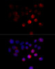 Immunofluorescence analysis of 293T cells using TOM1 antibody (23-823) at dilution of 1:100 (40x lens) . Blue: DAPI for nuclear staining.