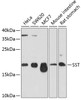 Western blot analysis of extracts of various cell lines, using SST antibody (23-824) at 1:1000 dilution.<br/>Secondary antibody: HRP Goat Anti-Rabbit IgG (H+L) at 1:10000 dilution.<br/>Lysates/proteins: 25ug per lane.<br/>Blocking buffer: 3% nonfat dry milk in TBST.<br/>Detection: ECL Basic Kit.<br/>Exposure time: 90s.