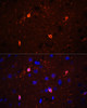 Immunofluorescence analysis of rat brain using CORO1A antibody (23-837) at dilution of 1:100 (40x lens) . Blue: DAPI for nuclear staining.