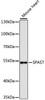 Western blot analysis of extracts of mouse heart, using SPAST antibody (23-878) at 1:3000 dilution.<br/>Secondary antibody: HRP Goat Anti-Rabbit IgG (H+L) at 1:10000 dilution.<br/>Lysates/proteins: 25ug per lane.<br/>Blocking buffer: 3% nonfat dry milk in TBST.<br/>Detection: ECL Enhanced Kit.<br/>Exposure time: 90s.