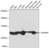 Western blot analysis of extracts of various cell lines, using ZRANB3 antibody (23-881) at 1:3000 dilution.<br/>Secondary antibody: HRP Goat Anti-Rabbit IgG (H+L) at 1:10000 dilution.<br/>Lysates/proteins: 25ug per lane.<br/>Blocking buffer: 3% nonfat dry milk in TBST.<br/>Detection: ECL Basic Kit.<br/>Exposure time: 20s.