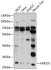 Western blot analysis of extracts of various cell lines, using AKR1D1 antibody (23-884) at 1:1000 dilution.<br/>Secondary antibody: HRP Goat Anti-Rabbit IgG (H+L) at 1:10000 dilution.<br/>Lysates/proteins: 25ug per lane.<br/>Blocking buffer: 3% nonfat dry milk in TBST.<br/>Detection: ECL Basic Kit.<br/>Exposure time: 5s.
