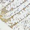 Immunohistochemistry of paraffin-embedded human colon using HACE1 antibody (23-886) at dilution of 1:100 (40x lens) .