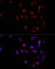 Immunofluorescence analysis of U2OS cells using HOXA2 antibody (23-891) at dilution of 1:100. Blue: DAPI for nuclear staining.