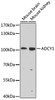 Western blot analysis of extracts of various cell lines, using ADCY1 antibody (23-902) at 1:1000 dilution.<br/>Secondary antibody: HRP Goat Anti-Rabbit IgG (H+L) at 1:10000 dilution.<br/>Lysates/proteins: 25ug per lane.<br/>Blocking buffer: 3% nonfat dry milk in TBST.<br/>Detection: ECL Enhanced Kit.<br/>Exposure time: 90s.