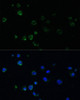 Immunofluorescence analysis of Jurkat cells using PMAIP1 antibody (23-907) at dilution of 1:100. Blue: DAPI for nuclear staining.