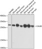 Western blot analysis of extracts of various cell lines, using CALB2 antibody (23-912) at 1:1000 dilution.<br/>Secondary antibody: HRP Goat Anti-Rabbit IgG (H+L) at 1:10000 dilution.<br/>Lysates/proteins: 25ug per lane.<br/>Blocking buffer: 3% nonfat dry milk in TBST.<br/>Detection: ECL Basic Kit.<br/>Exposure time: 1s.