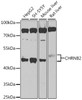 Western blot analysis of extracts of various cell lines, using CHRNB2 antibody (23-913) at 1:1000 dilution.<br/>Secondary antibody: HRP Goat Anti-Rabbit IgG (H+L) at 1:10000 dilution.<br/>Lysates/proteins: 25ug per lane.<br/>Blocking buffer: 3% nonfat dry milk in TBST.<br/>Detection: ECL Basic Kit.<br/>Exposure time: 90s.