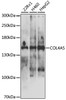 Western blot analysis of extracts of various cell lines, using COL4A5 antibody (23-914) at 1:1000 dilution.<br/>Secondary antibody: HRP Goat Anti-Rabbit IgG (H+L) at 1:10000 dilution.<br/>Lysates/proteins: 25ug per lane.<br/>Blocking buffer: 3% nonfat dry milk in TBST.<br/>Detection: ECL Basic Kit.<br/>Exposure time: 5s.