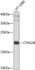 Western blot analysis of extracts of HT-1080 cells, using CTAG1B antibody (23-915) at 1:1000 dilution.<br/>Secondary antibody: HRP Goat Anti-Rabbit IgG (H+L) at 1:10000 dilution.<br/>Lysates/proteins: 25ug per lane.<br/>Blocking buffer: 3% nonfat dry milk in TBST.<br/>Detection: ECL Basic Kit.<br/>Exposure time: 15s.