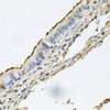 Immunohistochemistry of paraffin-embedded human trachea using DSG1 antibody (23-917) at dilution of 1:100 (40x lens) .
