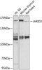 Western blot analysis of extracts of various cell lines, using JARID2 antibody (23-924) at 1:1000 dilution.<br/>Secondary antibody: HRP Goat Anti-Rabbit IgG (H+L) at 1:10000 dilution.<br/>Lysates/proteins: 25ug per lane.<br/>Blocking buffer: 3% nonfat dry milk in TBST.<br/>Detection: ECL Basic Kit.<br/>Exposure time: 10s.