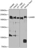 Western blot analysis of extracts of various cell lines, using LAMB1 antibody (23-927) at 1:1000 dilution.<br/>Secondary antibody: HRP Goat Anti-Rabbit IgG (H+L) at 1:10000 dilution.<br/>Lysates/proteins: 25ug per lane.<br/>Blocking buffer: 3% nonfat dry milk in TBST.<br/>Detection: ECL Basic Kit.<br/>Exposure time: 10s.