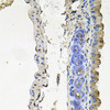 Immunohistochemistry of paraffin-embedded mouse lung using NDUFA6 antibody (23-930) at dilution of 1:100 (40x lens) .