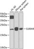 Western blot analysis of extracts of various cell lines, using S100A9 antibody (23-938) at 1:1000 dilution.<br/>Secondary antibody: HRP Goat Anti-Rabbit IgG (H+L) at 1:10000 dilution.<br/>Lysates/proteins: 25ug per lane.<br/>Blocking buffer: 3% nonfat dry milk in TBST.<br/>Detection: ECL Basic Kit.<br/>Exposure time: 90s.