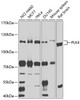 Western blot analysis of extracts of various cell lines, using PLK4 antibody (23-947) at 1:1000 dilution.<br/>Secondary antibody: HRP Goat Anti-Rabbit IgG (H+L) at 1:10000 dilution.<br/>Lysates/proteins: 25ug per lane.<br/>Blocking buffer: 3% nonfat dry milk in TBST.<br/>Detection: ECL Basic Kit.<br/>Exposure time: 15s.