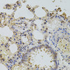 Immunohistochemistry of paraffin-embedded rat lung using PLK4 antibody (23-947) at dilution of 1:100 (40x lens) .