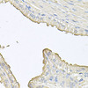 Immunohistochemistry of paraffin-embedded human prostate using FABP12 antibody (23-963) at dilution of 1:100 (40x lens) .