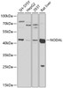 Western blot analysis of extracts of various cell lines, using NODAL antibody (23-967) at 1:1000 dilution.<br/>Secondary antibody: HRP Goat Anti-Rabbit IgG (H+L) at 1:10000 dilution.<br/>Lysates/proteins: 25ug per lane.<br/>Blocking buffer: 3% nonfat dry milk in TBST.<br/>Detection: ECL Basic Kit.<br/>Exposure time: 30s.