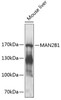 Western blot analysis of extracts of mouse liver, using MAN2B1 antibody (23-985) at 1:1000 dilution.<br/>Secondary antibody: HRP Goat Anti-Rabbit IgG (H+L) at 1:10000 dilution.<br/>Lysates/proteins: 25ug per lane.<br/>Blocking buffer: 3% nonfat dry milk in TBST.<br/>Detection: ECL Enhanced Kit.<br/>Exposure time: 30s.