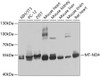 Western blot analysis of extracts of various cell lines, using MT-ND4 antibody (23-988) at 1:1000 dilution.<br/>Secondary antibody: HRP Goat Anti-Rabbit IgG (H+L) at 1:10000 dilution.<br/>Lysates/proteins: 25ug per lane.<br/>Blocking buffer: 3% nonfat dry milk in TBST.<br/>Detection: ECL Basic Kit.<br/>Exposure time: 90s.